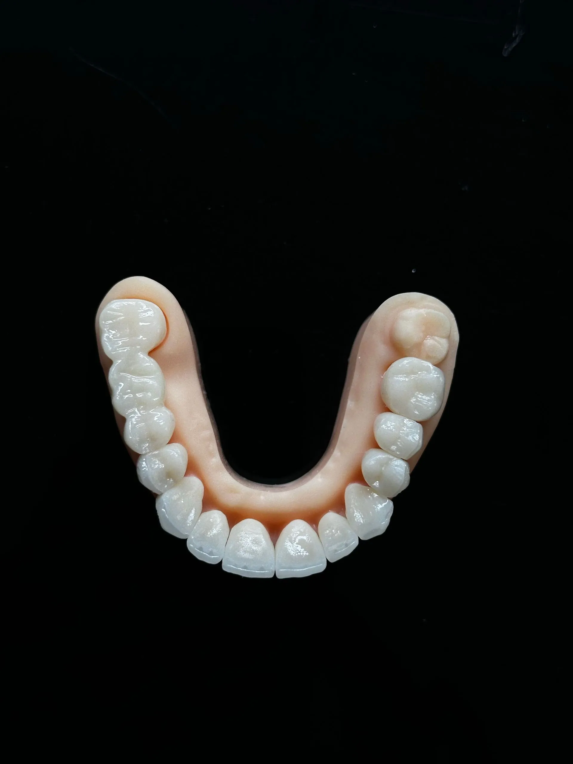 Profesional mostrando un modelo de prótesis dental completa en Clínica Dental Vigoar